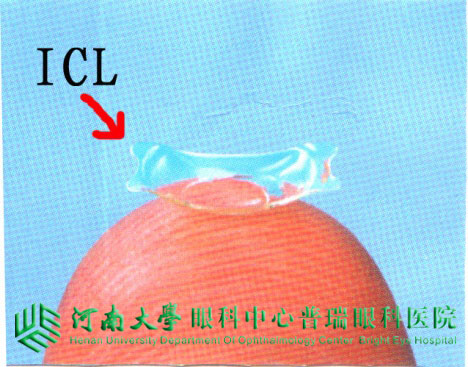 ICL植入術(shù)，高度近視患者的福音
