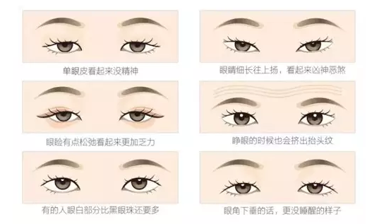 關于重瞼術，你要了解的那些事兒