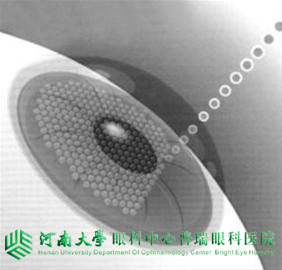 近視度數(shù)不同，手術(shù)方式怎么選