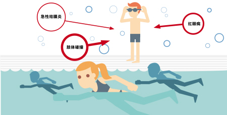夏季當(dāng)心紅眼病，網(wǎng)吧泳池成高發(fā)區(qū)
