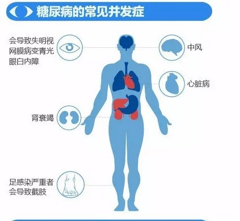 你造嗎？糖尿病晚期眼睛會致盲！