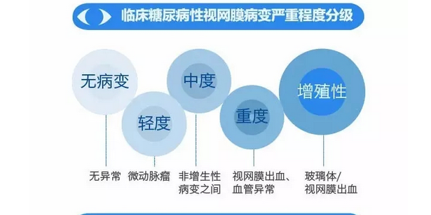 你造嗎？糖尿病晚期眼睛會致盲！