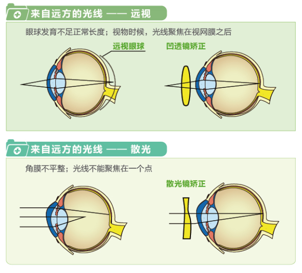 【看圖解】一張圖教你看懂近視、遠(yuǎn)視和散光