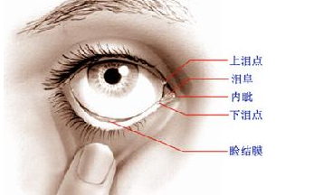 淚道病，眼部的隱形威脅