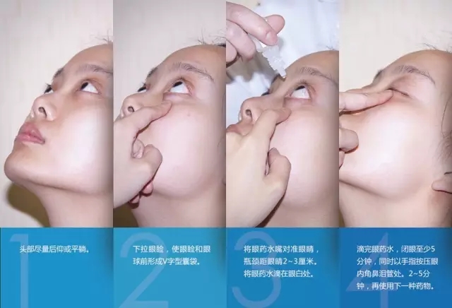 眼藥水你點(diǎn)對(duì)了嗎？快來(lái)看看！