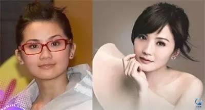 那些近視戴鏡暴丑的女明星們是做了什么變美了？？？